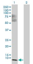 Anti-SS18L2 Mouse Polyclonal Antibody