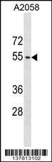 Anti-ACTL9 Rabbit Polyclonal Antibody (HRP (Horseradish Peroxidase))