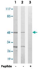 Anti-SLC16A14 Rabbit Polyclonal Antibody