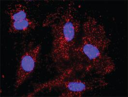 Anti-CDK2 + CDKN1B Antibody Pair