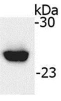 Western blotting using purified serum IgA