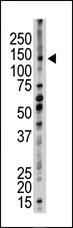 Anti-UBE4B Rabbit Polyclonal Antibody