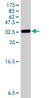 Anti-S100 A1 Mouse Polyclonal Antibody