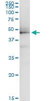 Anti-ILF2 Polyclonal Antibody Pair