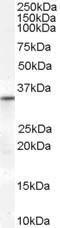 Antibody anti-VDAC2 A84247-100 100 µg