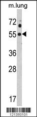 Anti-MCOLN1 Rabbit Polyclonal Antibody