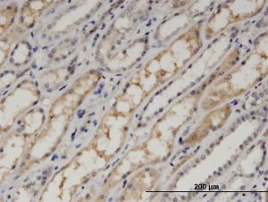 Anti-PDLIM1 Mouse Monoclonal Antibody [clone: 2D4]