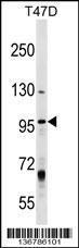 Anti-MCM8 Rabbit Polyclonal Antibody (HRP (Horseradish Peroxidase))