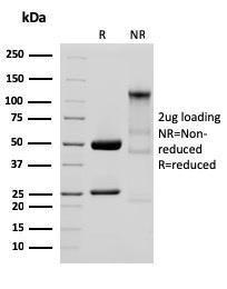 SDS-PAGE analysis of Anti-Glycoprotein 2 Antibody [GP2/3134R] under non-reduced and reduced conditions; showing intact IgG and intact heavy and light chains, respectively. SDS-PAGE analysis confirms the integrity and purity of the antibody.