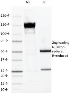 SDS-PAGE analysis of Anti-MUC1 Antibody [VU-2G7] under non-reduced and reduced conditions; showing intact IgG and intact heavy and light chains, respectively. SDS-PAGE analysis confirms the integrity and purity of the antibody