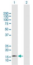 Anti-ZMAT4 Rabbit Polyclonal Antibody