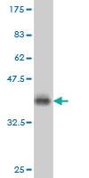 Anti-PRKCD Mouse Monoclonal Antibody [clone: 6A2]