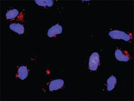 Anti-CDKN1A + MDM2 Antibody Pair