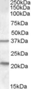 EB08380 (1 µg/ml) staining of Human Liver lysate (35 µg protein in RIPA buffer).  Primary incubation was 1 hour.  Detected by chemiluminescence.