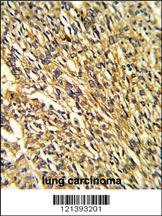 Anti-KCNJ2 Rabbit Polyclonal Antibody