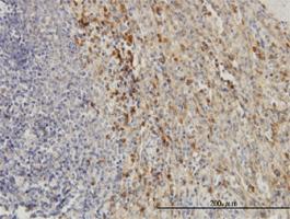 Anti-TIMP2 Mouse Monoclonal Antibody [clone: 5B11]