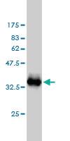 Anti-S100 A1 Mouse Monoclonal Antibody [clone: 1D5]