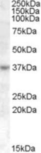 EB08383 (1 µg/ml) staining of Jurkat cell lysate (35 µg protein in RIPA buffer).  Primary incubation was 1 hour.  Detected by chemiluminescence.