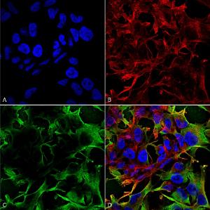 Immunocytochemistry/Immunofluorescence analysis of human neuroblastoma cell line (SK-N-BE, fixed in 4% formaldehyde for 15 min at room temperature, using Anti-Neuroligin 3 Antibody [S110-29] (A304790), at 1:100 for 60 minutes at room temperatur