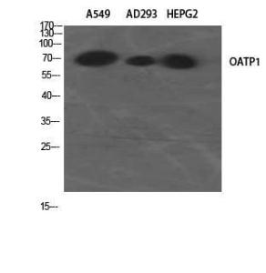 Western blot analysis of A549 AD293 HEPG2 using Anti-SLCO1A2 Antibody