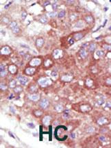 Anti-UBE2D1 Rabbit Polyclonal Antibody