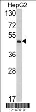 Anti-OTC Rabbit Polyclonal Antibody