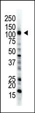 Anti-E1 Ubiquitin (UBE1) Rabbit Polyclonal Antibody