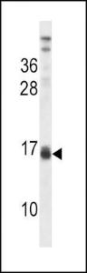 Anti-LALBA Rabbit Polyclonal Antibody (AP (Alkaline Phosphatase))