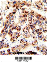 Anti-OTC Rabbit Polyclonal Antibody