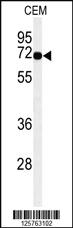 Anti-MFSD6 Rabbit Polyclonal Antibody