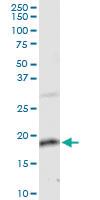 Anti-ZMAT4 Rabbit Polyclonal Antibody