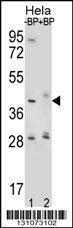 Anti-HYAL2 Rabbit Polyclonal Antibody (AP (Alkaline Phosphatase))