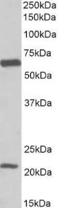 Anti-SLC1A3 Antibody (A82699) (01 µg/ml) staining of Human Frontal Cortex lysate (35 µg protein in RIPA buffer) Primary incubation was 1 hour Detected by chemiluminescence