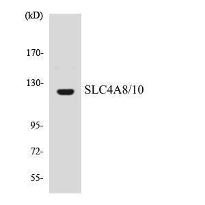 Western blot analysis of the lysates from HUVEC cells using Anti-SLC4A8 + SLC4A10 Antibody