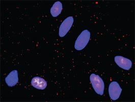 Anti-EGFR + FOS Antibody Pair