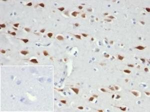 Immunohistochemical analysis of formalin-fixed, paraffin-embedded human brain tissue using Anti-NeuN Antibody [NeuN/6694R]. Inset: PBS instead of the primary antibody. Secondary antibody negative control