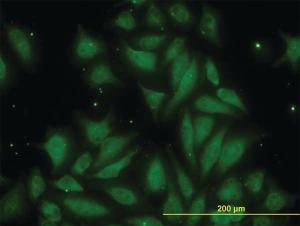 Anti-TIMP2 Mouse Monoclonal Antibody [clone: 5B11]