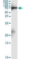 Anti-ZYX Antibody Pair