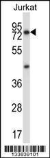 Anti-MCOLN1 Rabbit Polyclonal Antibody (Biotin)