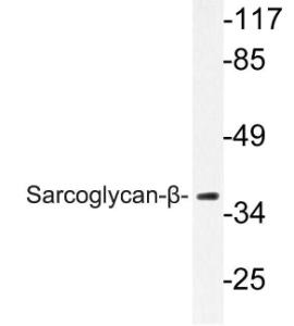 Western blot analysis of lysate from A549 cells using Anti-Sarcoglycan-beta Antibody