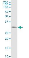 Anti-PRKG1 Rabbit Polyclonal Antibody