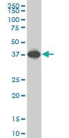 Anti-SPP1 Mouse Monoclonal Antibody [clone: 3B11]