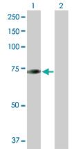 Anti-CDKN2AIP Rabbit Polyclonal Antibody