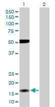 Anti-ZMAT4 Rabbit Polyclonal Antibody