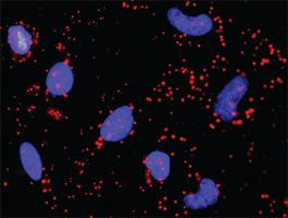 Anti-TRAF2 + CDKN1B Antibody Pair