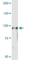 Anti-RIN1 Polyclonal Antibody Pair