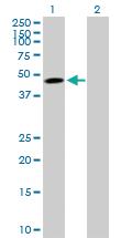 Anti-TNFRSF10B Mouse Polyclonal Antibody