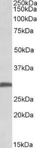 Anti-FGF13 Antibody (A82701) (0.5 µg/ml) staining of Mouse Brain lysate (35 µg protein in RIPA buffer). Primary incubation was 1 hour. Detected by chemiluminescence