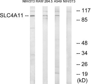 Western blot analysis of lysates from NIH/3T3, RAW264.7, and A549 cells using Anti-SLC4A11 Antibody. The right hand lane represents a negative control, where the Antibody is blocked by the immunising peptide