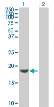 Anti-NDUFB6 Mouse Polyclonal Antibody